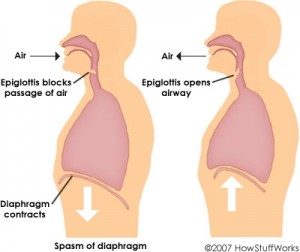 Babies and Hiccups--What Gives?