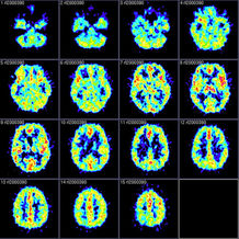 bonding with baby, benfits of breastfeeding, mommy brain, American Psychological Association, high-resolution magnetic-resonance imaging, Yale-New Haven Hospital, gray matter,post-partum depression,